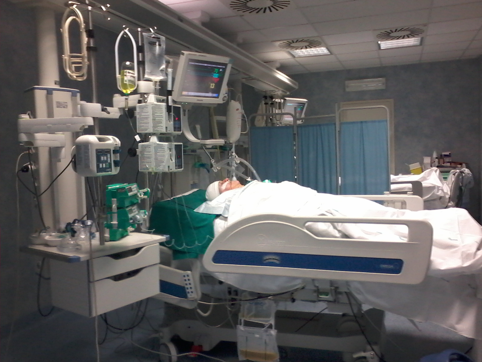 بخش ICU و CCU